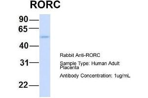 Host:  Rabbit  Target Name:  RORC  Sample Type:  Human Adult Placenta  Antibody Dilution:  1.