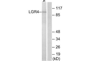 Western blot analysis of extracts from Jurkat cells, using LGR4 antibody. (LGR4 antibody  (Internal Region))