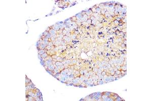 Immunohistochemistry of paraffin-embedded mouse testis using Integrin alpha 4 (ITG/CD49d) (ITG/CD49d) Rabbit mAb (054) at dilution of 1:100 (40x lens). (ITGA4 antibody)