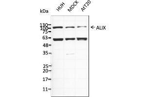Western Blotting (WB) image for anti-Programmed Cell Death 6 Interacting Protein (PDCD6IP) (C-Term) antibody (ABIN7273068) (ALIX antibody  (C-Term))