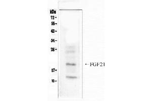 Western blot analysis of FGF21  using anti- FGF21 antibody . (FGF21 antibody  (N-Term))