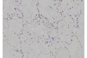 ABIN6277196 at 1/100 staining Human lung tissue by IHC-P. (Histone 3 antibody  (H3K9me2))