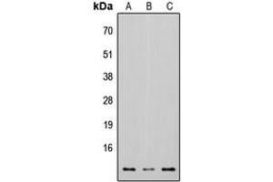 Western blot analysis of Osteocalcin expression in HEK293T (A), Raw264. (Osteocalcin antibody  (Center))