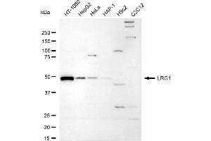 Western blotting analysis using LRG1 antibody (ABIN7799253).