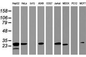Western Blotting (WB) image for anti-Hydroxysteroid (17-Beta) Dehydrogenase 8 (HSD17B8) (AA 57-261) antibody (ABIN2715557) (HSD17B8 antibody  (AA 57-261))