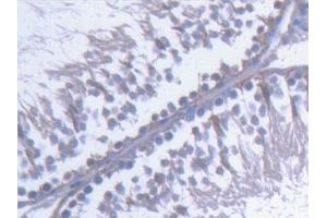 Detection of KTN1 in Rat Testis Tissue using Polyclonal Antibody to Kinectin 1 (KTN1) (KTN1 antibody  (AA 1162-1325))