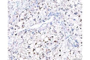 IHC analysis of GGCX using anti-GGCX antibody (ABIN7602419). (GGCX antibody  (AA 75-730))