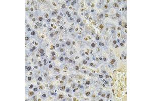 Immunohistochemistry of paraffin-embedded rat liver using PSMC3 Antibody (ABIN5971034) at dilution of 1/100 (40x lens).