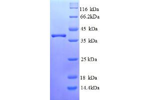 SDS-PAGE (SDS) image for Ring Finger Protein 7 (RNF7) (AA 2-113) protein (GST tag) (ABIN4975946)