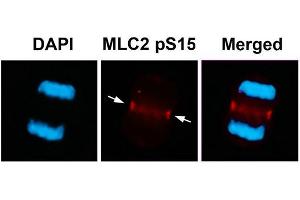 Immunofluorescence staining of methanol-fixed U87 cells using MLC2 (Phospho-Ser15) Antibody. (MYL9 antibody  (pSer15))