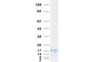 Western Blotting (WB) image for Cardiac Troponin C (TNNC1) protein (Myc-DYKDDDDK Tag) (ABIN2713170)