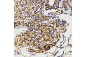 Immunohistochemistry (IHC) image for anti-Glutamate Receptor, Metabotropic 8 (GRM8) antibody (ABIN3017086) (GRM8 antibody)