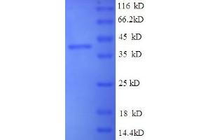 SDS-PAGE (SDS) image for VP2 (AA 2-351) protein (His-SUMO Tag) (ABIN5711063) (VP2 (AA 2-351) protein (His-SUMO Tag))