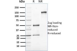 SDS-PAGE Analysis Purified Involucrin Mouse Monoclonal Antibody (SPM259). (Involucrin antibody)