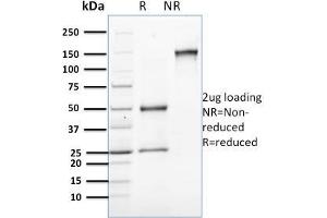 SDS-PAGE Analysis Purified Involucrin Mouse Monoclonal Antibody (SPM259).