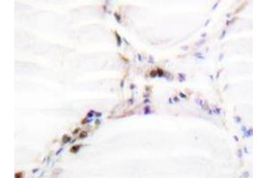 Immunohistochemistry analysis of Vitamin D3 receptor / NR1I1 antibody in paraffin-embedded human thyroid gland tissue. (Vitamin D Receptor antibody)