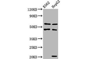 Western Blot Positive WB detected in: K562 whole cell lysate, HepG2 whole cell lysate All lanes: GATB antibody at 3. (PET112L antibody  (AA 301-383))