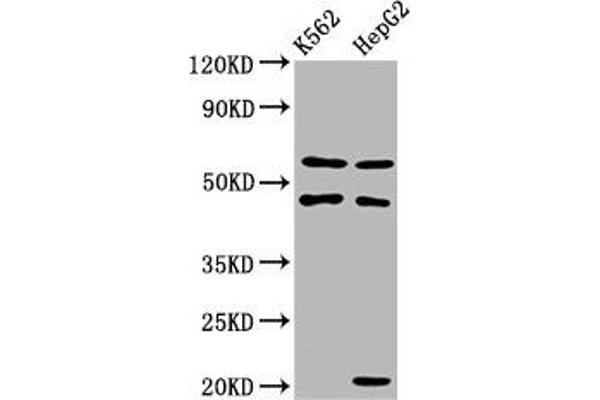 PET112L anticorps  (AA 301-383)