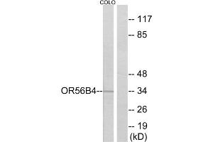 Western blot analysis of extracts from COLO cells, using OR56B4 antibody.
