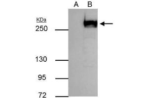 Immunoprecipitation (IP) image for anti-Mechanistic Target of Rapamycin (serine/threonine Kinase) (mTOR) (C-Term) antibody (ABIN2855088)