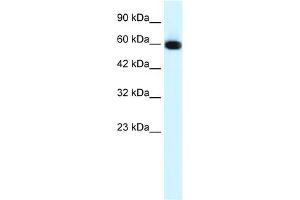 WB Suggested Anti-GLIS2 Antibody Titration:  0. (GLIS2 antibody  (N-Term))