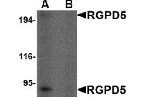 Western Blotting (WB) image for anti-RANBP2-Like and GRIP Domain Containing 5 (RGPD5) (Middle Region) antibody (ABIN1031059) (RGPD5 antibody  (Middle Region))