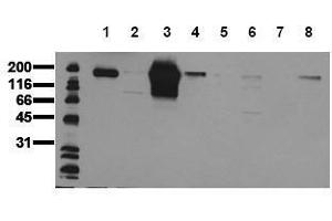 Western Blotting (WB) image for anti-Receptor tyrosine-protein kinase erbB-2 (ErbB2/Her2) (AA 860-880) antibody (ABIN126788) (ErbB2/Her2 antibody  (AA 860-880))