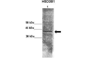 Lanes : Lane 1: 50ug monkey brain extract  Primary Antibody Dilution :  1:1000   Secondary Antibody : Goat anti rabbit-HRP  Secondary Antibody Dilution :  1:10,000  Gene Name : HSD3B1  Submitted by : Jonathan Bertin, Endoceutics Inc. (HSD3B1 antibody  (N-Term))