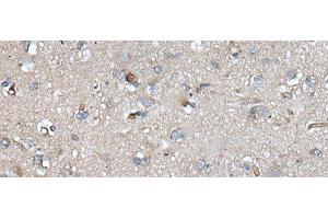Immunohistochemistry of paraffin-embedded Human brain tissue using UMPS Polyclonal Antibody at dilution of 1:40(x200) (UMPS antibody)