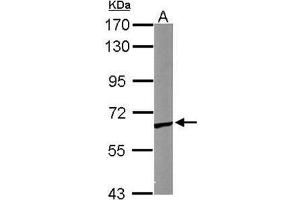 TCP1 epsilon Antibody staining of Mouse Brain (A) whole cell lysate (30 µg) at 1/1000 dilution, 7. (CCT5 antibody  (AA 1-224))