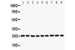 Western Blotting (WB) image for anti-Superoxide Dismutase 2, Mitochondrial (SOD2) (AA 45-62), (N-Term) antibody (ABIN3044165)