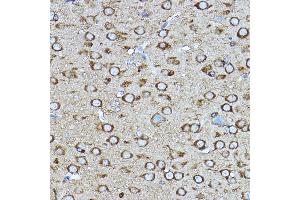 Immunohistochemistry of paraffin-embedded mouse brain using [KO Validated] CRMP2/CRMP2/DPYSL2 Rabbit pAb (ABIN7266769) at dilution of 1:400 (40x lens). (DPYSL2 antibody  (AA 400-500))