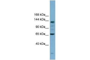 WB Suggested Anti-IARS Antibody Titration: 0. (IARS antibody  (N-Term))