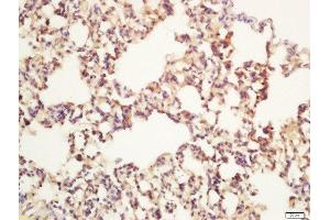 Formalin-fixed and paraffin embedded rat lung labeled with Rabbit Anti-Apg12 Polyclonal Antibody, Unconjugated  at 1:200 followed by conjugation to the secondary antibody and DAB staining (ATG12 antibody  (AA 101-187))