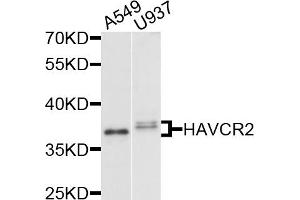 Western blot analysis of extracts of various cell lines, using HAVCR2 antibody (ABIN5971348) at 1/1000 dilution. (TIM3 antibody)
