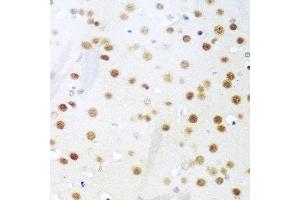 Immunohistochemistry of paraffin-embedded mouse brain using UNG antibody at dilution of 1:100 (40x lens). (UNG antibody)