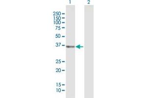 Western Blot analysis of UCHL5 expression in transfected 293T cell line by UCHL5 MaxPab polyclonal antibody. (UCHL5 antibody  (AA 1-326))