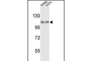 Western blot analysis of HSPH1 Antibody (C-term) (ABIN389381 and ABIN2839476) in  and  cell line lysates (35 μg/lane). (HSPH1 antibody  (C-Term))