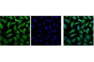 Immunofluorescence (IF) image for anti-Keratin 18 (KRT18) antibody (ABIN7178499)