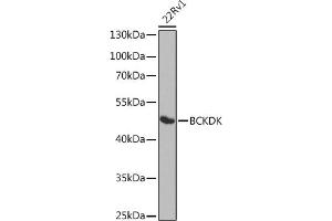 Western blot analysis of extracts of 22Rv1 cells, using BCKDK antibody (ABIN6127484, ABIN6137492, ABIN6137493 and ABIN6224210) at 1:1000 dilution. (BCKDK antibody  (AA 153-412))