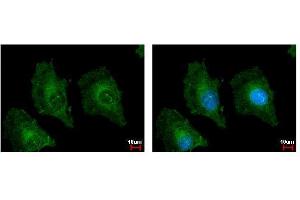 ICC/IF Image TSPAN3 antibody detects TSPAN3 protein at cytoplasm by immunofluorescent analysis. (Tetraspanin 3 antibody)