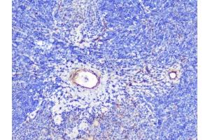 IHC analysis of INPPL1 using anti-INPPL1 antibody (ABIN6719492). (INPPL1 antibody  (AA 1172-1258))