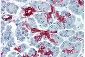 Human Pancreas (formalin-fixed, paraffin-embedded) stained with KRT19 antibody ABIN396943 at 10 ug/ml followed by biotinylated anti-mouse IgG secondary antibody ABIN481714, alkaline phosphatase-streptavidin and chromogen. (Cytokeratin 19 antibody)
