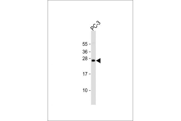 DDIT3 antibody  (C-Term)