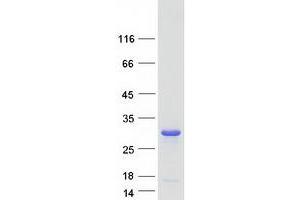 Validation with Western Blot (VPS28 Protein (Transcript Variant 1) (Myc-DYKDDDDK Tag))