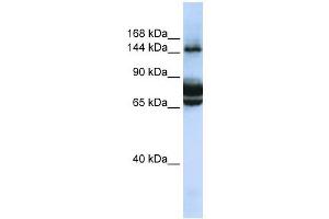 FAM83B antibody used at 1 ug/ml to detect target protein. (FAM83B antibody  (C-Term))