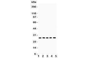 Western blot testing of ERAB antibody and Lane 1:  mouse lung (HSD17B10 antibody  (AA 48-261))