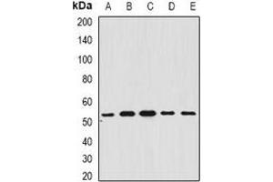 Western blot analysis of BAR expression in A549 (A), SHSY5Y (B), mouse brain (C), mouse liver (D), rat heart (E) whole cell lysates. (BFAR antibody)