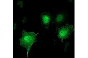 Anti-SH2D2A mouse monoclonal antibody (ABIN2455606) immunofluorescent staining of COS7 cells transiently transfected by pCMV6-ENTRY SH2D2A (RC204162). (SH2D2A antibody)