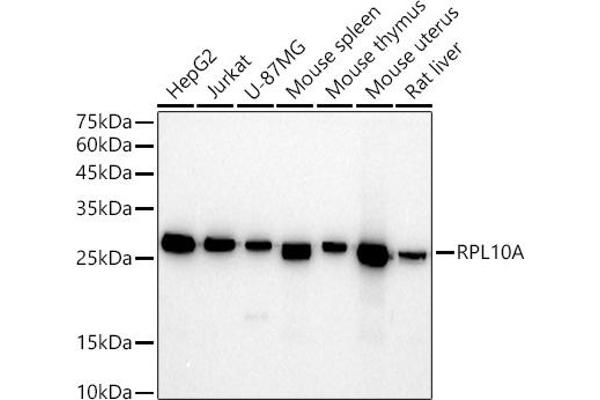 RPL10A 抗体